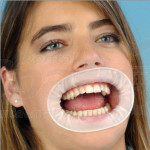 Dental Disposable Sterile Rubber Dam Teeth Whitening Oral Cheek Retractor Mouth Opener 10 Pack
